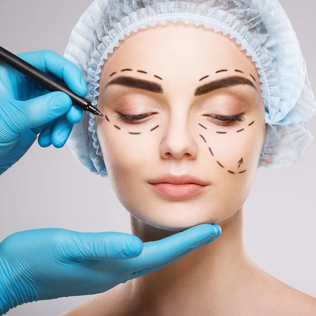 face surgery