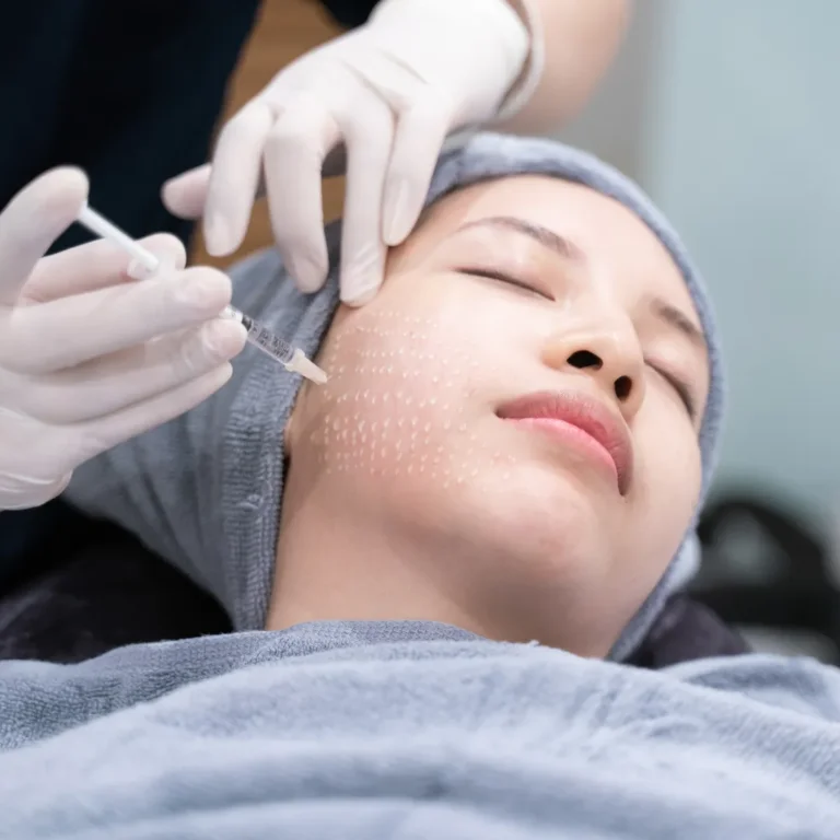 woman having prp treatment