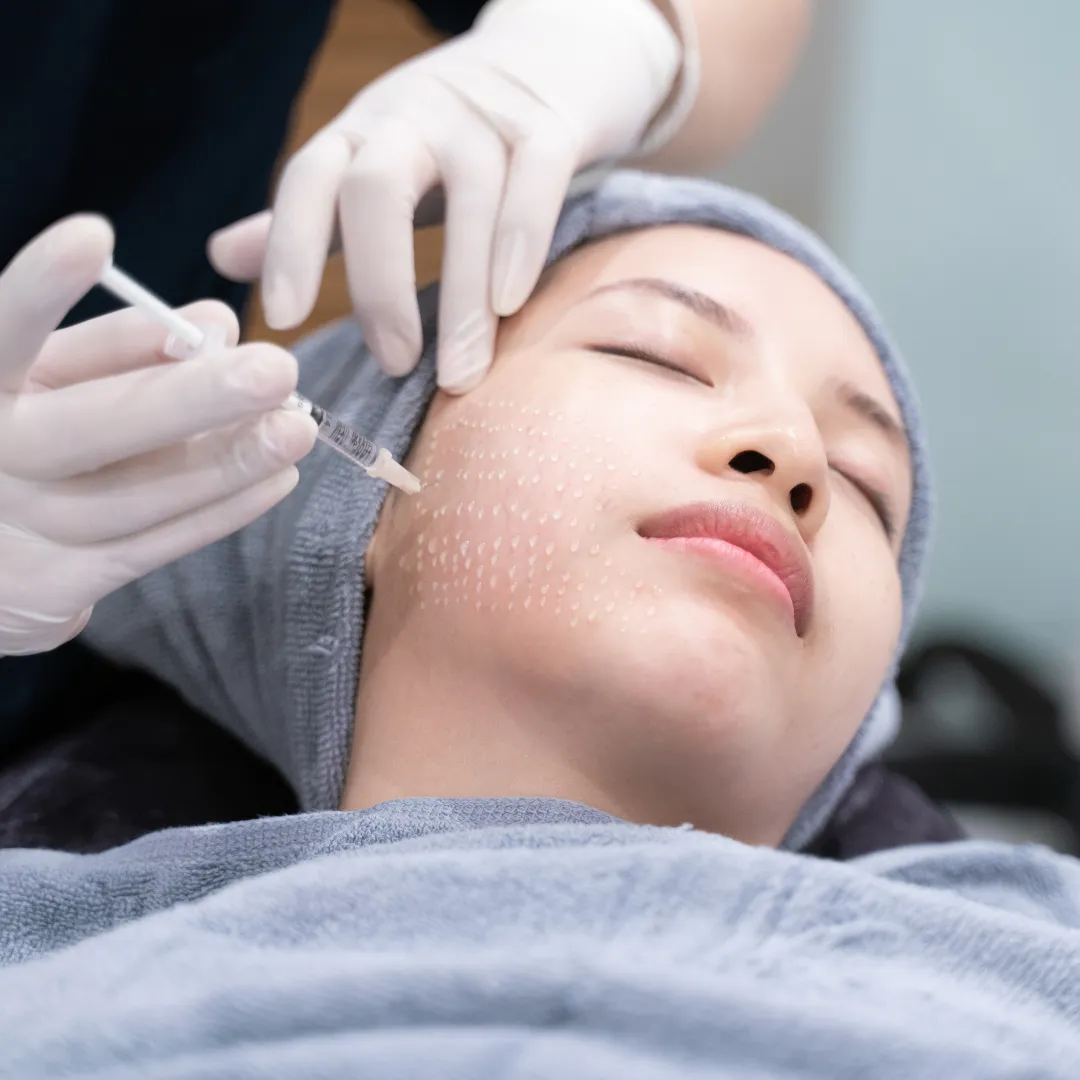 woman having prp treatment